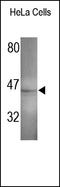Mitogen-Activated Protein Kinase 8 antibody, 252187, Abbiotec, Western Blot image 