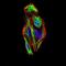 Snail Family Transcriptional Repressor 2 antibody, NBP2-52570, Novus Biologicals, Immunocytochemistry image 