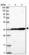 DnaJ Heat Shock Protein Family (Hsp40) Member B14 antibody, PA5-57494, Invitrogen Antibodies, Western Blot image 