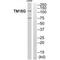 Anoctamin 7 antibody, PA5-49839, Invitrogen Antibodies, Western Blot image 