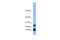 Hepcidin Antimicrobial Peptide antibody, ARP41620_P050, Aviva Systems Biology, Western Blot image 