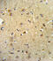Oxidized Low Density Lipoprotein Receptor 1 antibody, abx034133, Abbexa, Immunohistochemistry paraffin image 