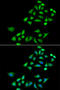 Kallikrein Related Peptidase 4 antibody, abx005091, Abbexa, Western Blot image 