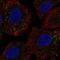 Coiled-Coil Domain Containing 65 antibody, HPA057573, Atlas Antibodies, Immunofluorescence image 