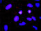 ADAM Metallopeptidase Domain 17 antibody, LS-B4426, Lifespan Biosciences, Proximity Ligation Assay image 