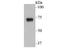 Sodium Channel Epithelial 1 Gamma Subunit antibody, NBP2-76964, Novus Biologicals, Western Blot image 
