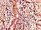 COMM domain-containing protein 1 antibody, orb46447, Biorbyt, Immunohistochemistry paraffin image 