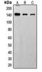 Fibroblast Growth Factor Receptor 1 antibody, GTX32182, GeneTex, Western Blot image 