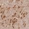 Diphosphoinositol Pentakisphosphate Kinase 2 antibody, NBP2-38368, Novus Biologicals, Immunohistochemistry frozen image 