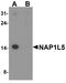 Nucleosome Assembly Protein 1 Like 5 antibody, A14492, Boster Biological Technology, Western Blot image 