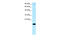 Cbp/P300 Interacting Transactivator With Glu/Asp Rich Carboxy-Terminal Domain 1 antibody, 27-673, ProSci, Immunohistochemistry paraffin image 