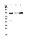 Glucosamine (N-Acetyl)-6-Sulfatase antibody, A00999-1, Boster Biological Technology, Western Blot image 