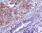 TNF Receptor Superfamily Member 12A antibody, ab109365, Abcam, Immunohistochemistry paraffin image 