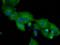 Insulin receptor substrate 2 antibody, orb373871, Biorbyt, Immunocytochemistry image 