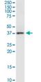 Receptor activity-modifying protein 3 antibody, H00010268-M01, Novus Biologicals, Western Blot image 