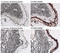 Keratin 1 antibody, LS-C343835, Lifespan Biosciences, Immunohistochemistry paraffin image 