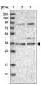 Kelch Domain Containing 3 antibody, NBP1-85196, Novus Biologicals, Western Blot image 