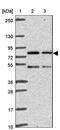 Tetratricopeptide Repeat Domain 30A antibody, NBP2-46792, Novus Biologicals, Western Blot image 