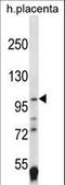 HIF-2-alpha antibody, LS-C167779, Lifespan Biosciences, Western Blot image 