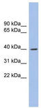 GLI Family Zinc Finger 4 antibody, TA341449, Origene, Western Blot image 