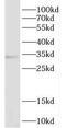 Dehydrodolichyl Diphosphate Synthase Subunit antibody, FNab02363, FineTest, Western Blot image 