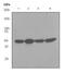 RB Binding Protein 4, Chromatin Remodeling Factor antibody, ab79416, Abcam, Western Blot image 