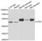 Chitinase Acidic antibody, LS-C334794, Lifespan Biosciences, Western Blot image 