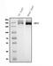 Bone Morphogenetic Protein Receptor Type 2 antibody, A00324-2, Boster Biological Technology, Western Blot image 