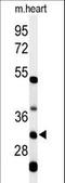 Holocytochrome C Synthase antibody, LS-C166807, Lifespan Biosciences, Western Blot image 