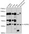 RCC1 And BTB Domain Containing Protein 2 antibody, 19-161, ProSci, Western Blot image 