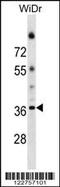 ALG5 Dolichyl-Phosphate Beta-Glucosyltransferase antibody, 59-493, ProSci, Western Blot image 