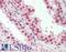 Homeobox D13 antibody, LS-B9215, Lifespan Biosciences, Immunohistochemistry frozen image 