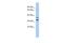 Testis Specific 13 antibody, A17796, Boster Biological Technology, Western Blot image 