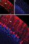 Nectin Cell Adhesion Molecule 1 antibody, PA5-77524, Invitrogen Antibodies, Immunohistochemistry paraffin image 