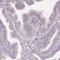 Ankyrin Repeat Domain 31 antibody, HPA057566, Atlas Antibodies, Immunohistochemistry paraffin image 