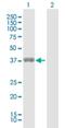 ETS Variant 7 antibody, H00051513-D01P, Novus Biologicals, Western Blot image 