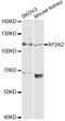 Adaptor Related Protein Complex 2 Subunit Alpha 2 antibody, LS-C748332, Lifespan Biosciences, Western Blot image 