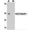 Synaptogyrin 1 antibody, MBS151196, MyBioSource, Western Blot image 