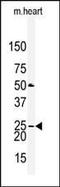 Claudin 2 antibody, PA5-13334, Invitrogen Antibodies, Western Blot image 