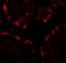 CF Transmembrane Conductance Regulator antibody, A00028, Boster Biological Technology, Immunofluorescence image 
