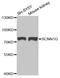 Sodium Channel Epithelial 1 Gamma Subunit antibody, abx006807, Abbexa, Western Blot image 