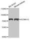 Sodium Channel Epithelial 1 Gamma Subunit antibody, abx006807, Abbexa, Western Blot image 