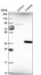 Charged Multivesicular Body Protein 6 antibody, PA5-54661, Invitrogen Antibodies, Western Blot image 