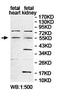 Patatin Like Phospholipase Domain Containing 2 antibody, orb78393, Biorbyt, Western Blot image 