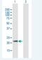 ADP Ribosylation Factor Like GTPase 6 antibody, H00084100-B01P-50ug, Novus Biologicals, Western Blot image 