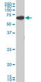 Checkpoint Kinase 2 antibody, LS-B6213, Lifespan Biosciences, Western Blot image 