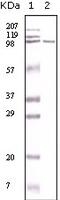 MutS Homolog 2 antibody, 32-196, ProSci, Enzyme Linked Immunosorbent Assay image 