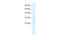 Proteasome 26S Subunit, Non-ATPase 14 antibody, 27-600, ProSci, Enzyme Linked Immunosorbent Assay image 