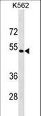 Proteasome 26S Subunit, Non-ATPase 4 antibody, LS-C155867, Lifespan Biosciences, Western Blot image 