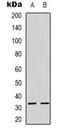 ATP Synthase F1 Subunit Gamma antibody, orb318806, Biorbyt, Western Blot image 